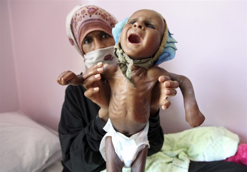 UN Agency Says Famine in Yemen Endangering 2 Million Mothers UN Agency Says Famine in Yemen Endangering 2 Million Mothers